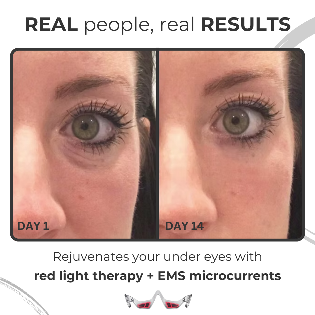 Under Eye Anti-Aging Glasses | Red Light Therapy & Microcurrent for Reducing Wrinkles, Dark Circles & Puffiness