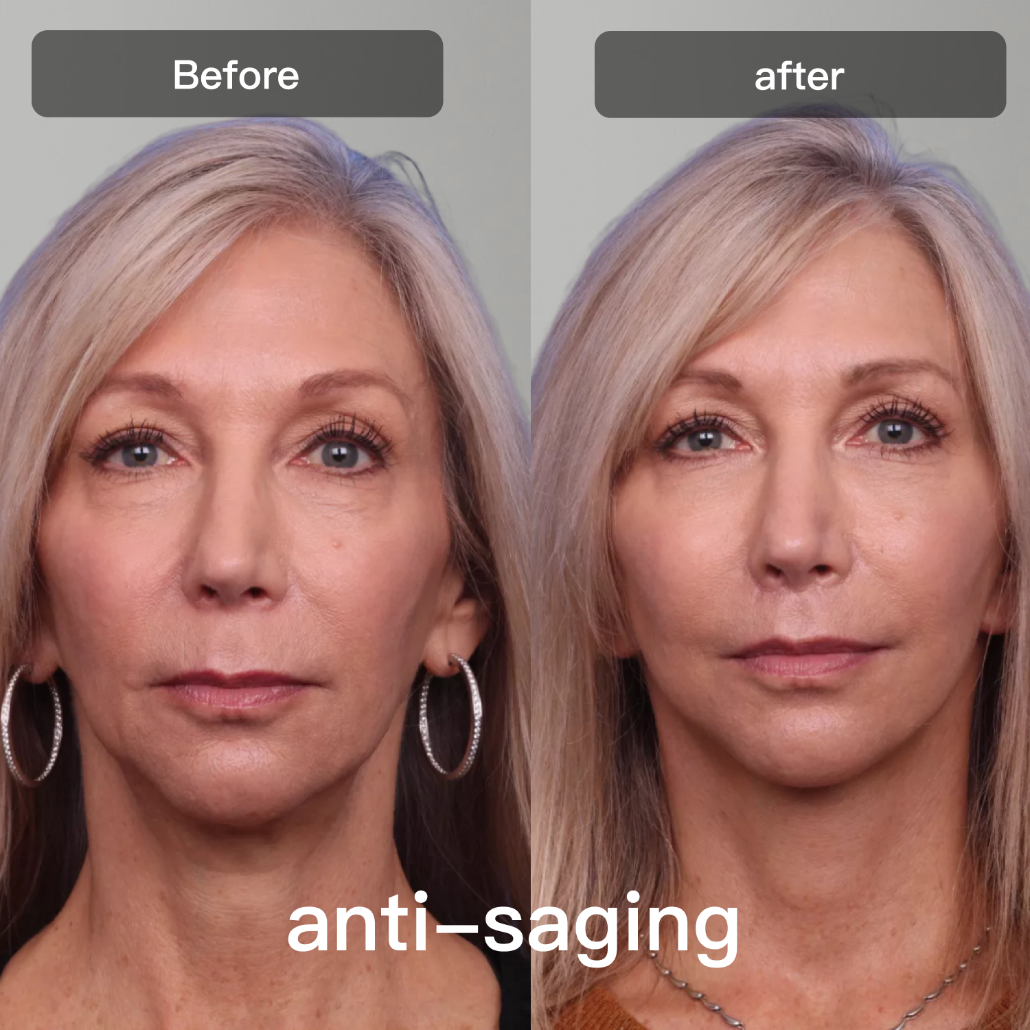 LED Light Therapy Device | 7-in-1 Color Treatment for Face & Body, Reduces Fine Lines, Acne, Inflammation & Pigmentation