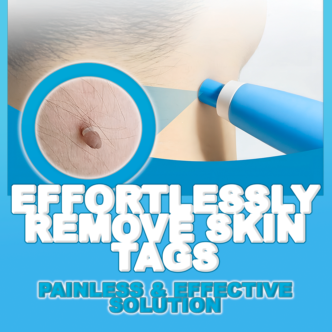 Skin Tag Remover Pen - Painless, Fast-Acting Treatment for Skin Tags, Moles, and Warts at Home