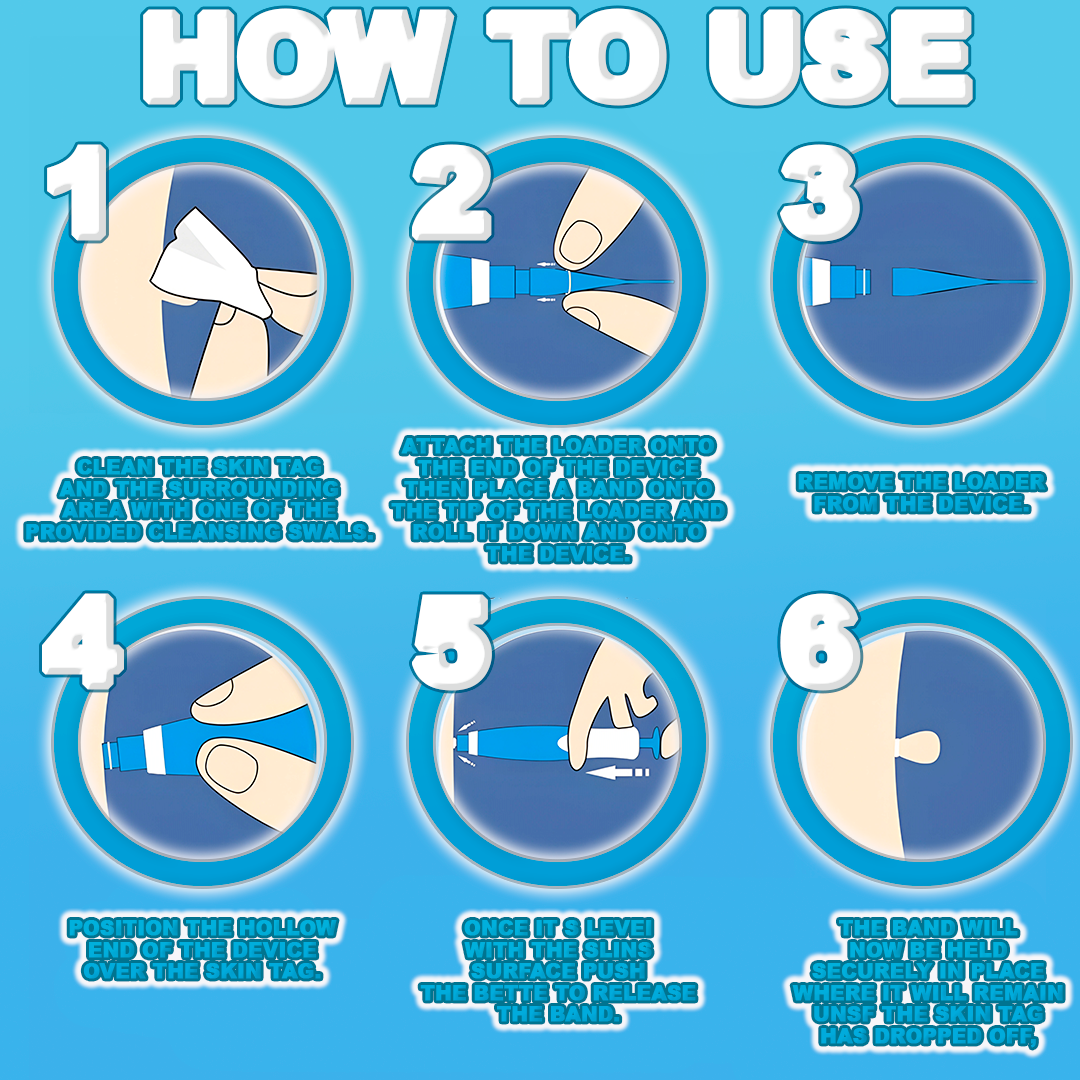 Skin Tag Remover Pen - Painless, Fast-Acting Treatment for Skin Tags, Moles, and Warts at Home