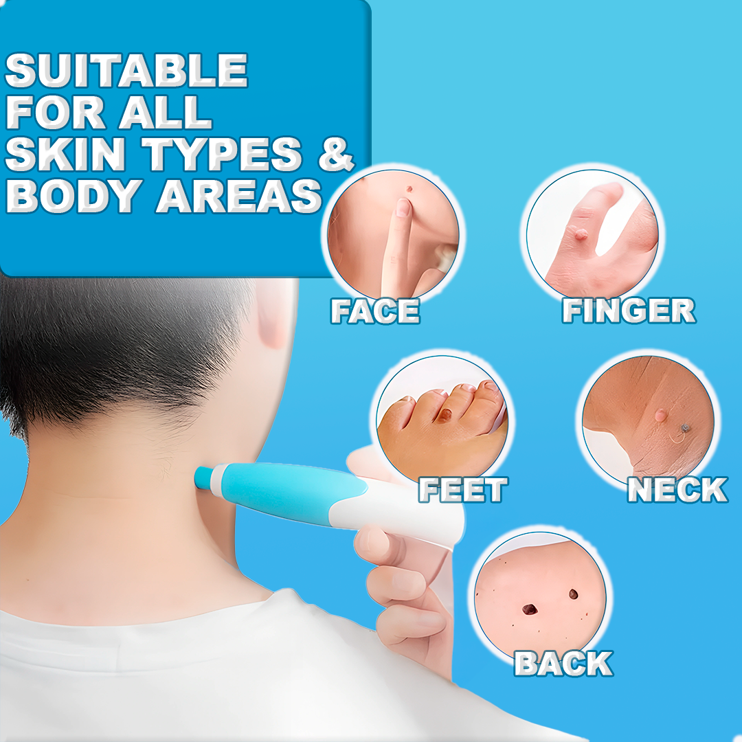 Skin Tag Remover Pen - Painless, Fast-Acting Treatment for Skin Tags, Moles, and Warts at Home