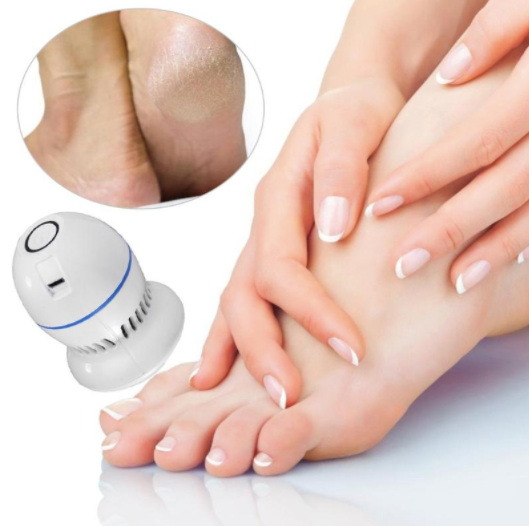 Callus Remover - Foot Callus Remover 1